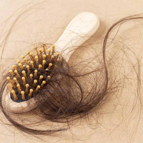 coiffeur antibes femme, chute de cheveux